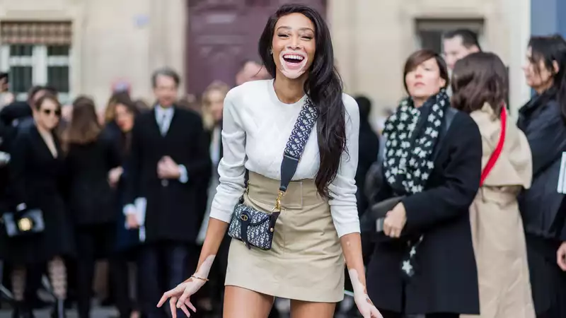 Winnie Harlow's work clothes